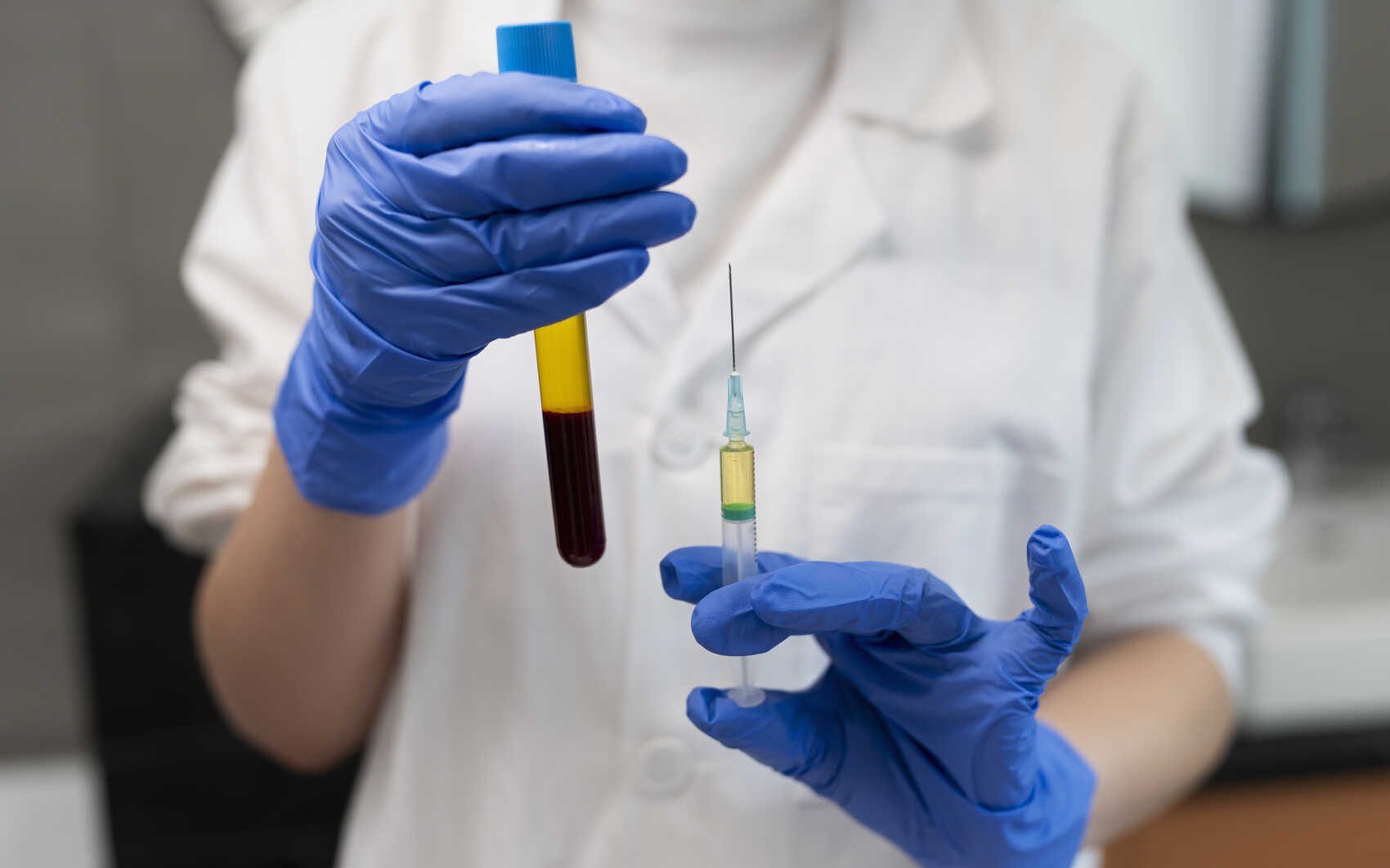 platelet rich plasma therapy